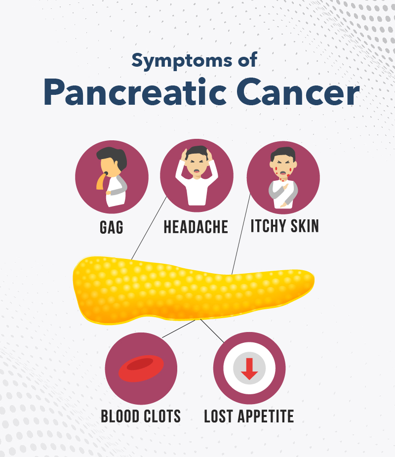 symptoms of pancreatic Cancer