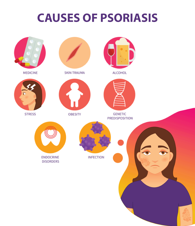 causes of Psoriasis