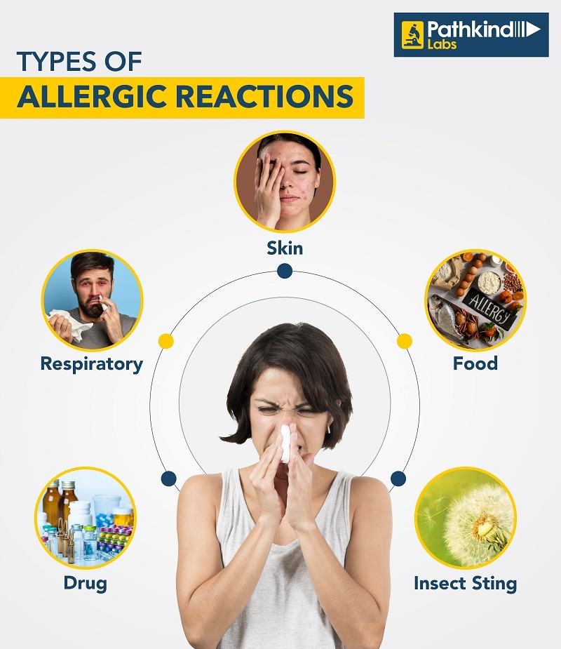 types-of-allergic-reaction