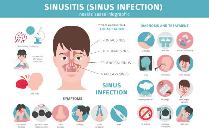 e visit for sinus infection