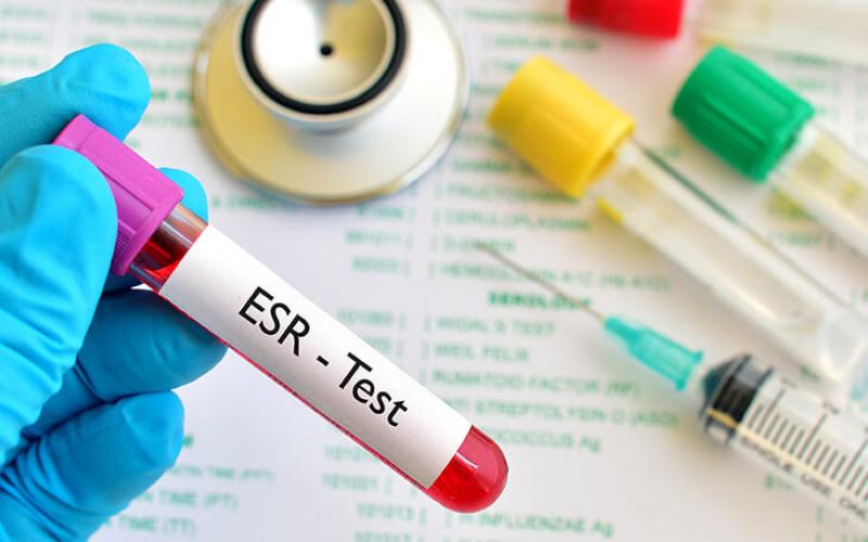 ESR Test: Overview, Risks, and Results