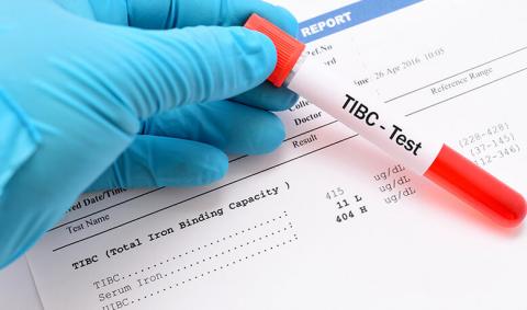 Total iron-binding capacity (TIBC) and transferrin test