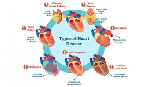 types of Heart Diseases