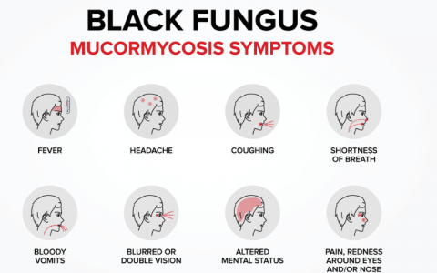 Black Fugus Infection