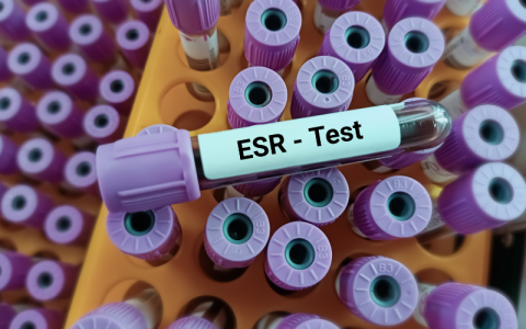 ESR Blood Test