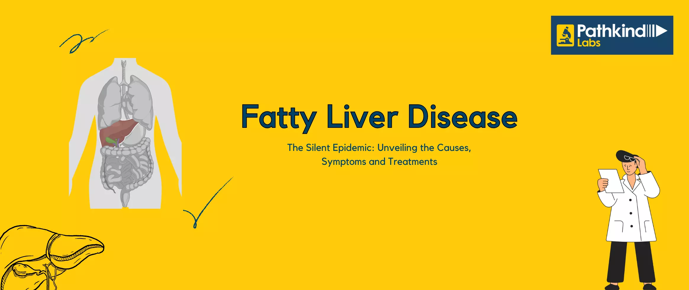 Causes, Symptoms and Treatments of Fatty Liver Disease