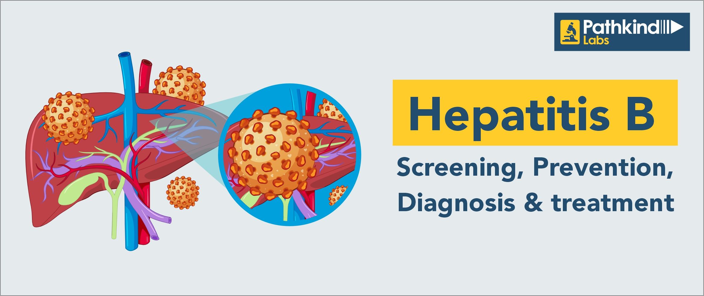 Hepatitis B - Screening, Prevention, Diagnosis & Treatment