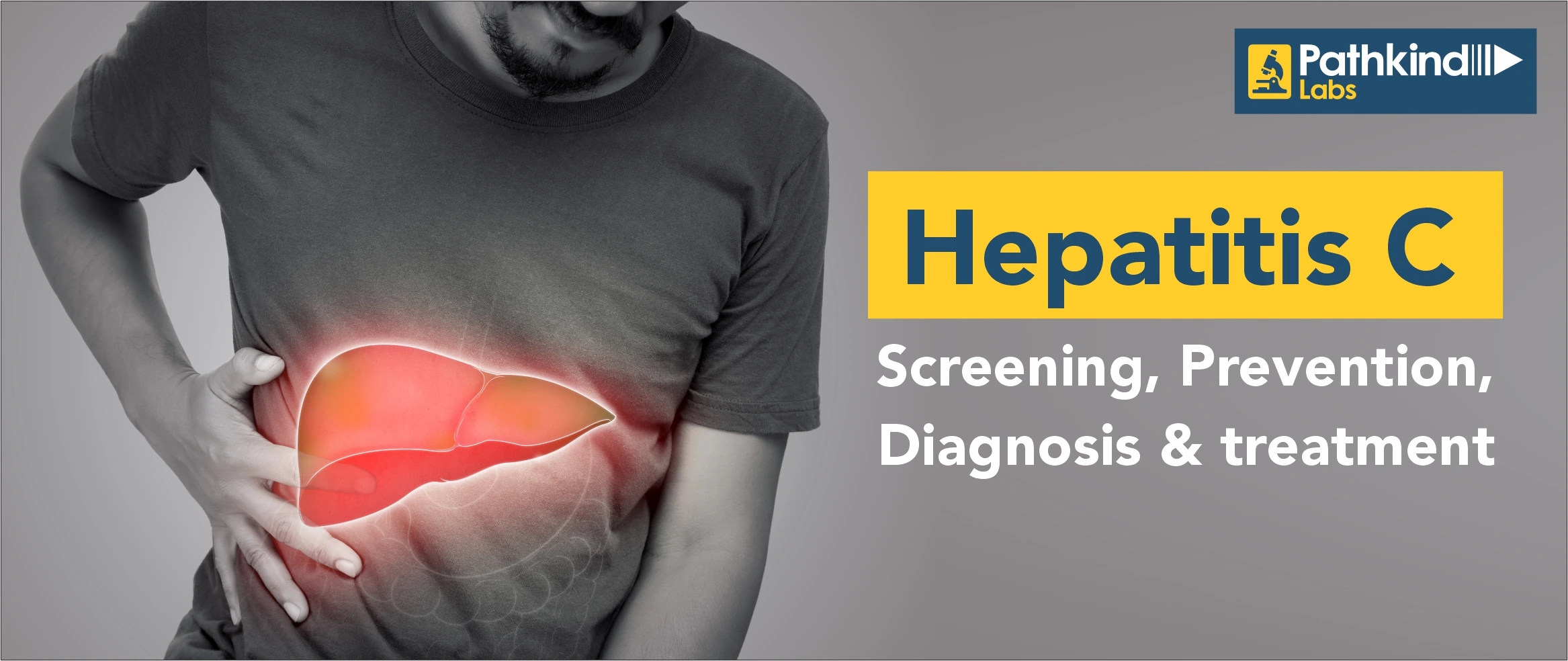 Hepatitis C- Screening, Prevention, Diagnosis & Treatment