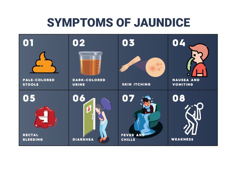 Jaundice: Causes, Symptoms, and Diagnostic Tests