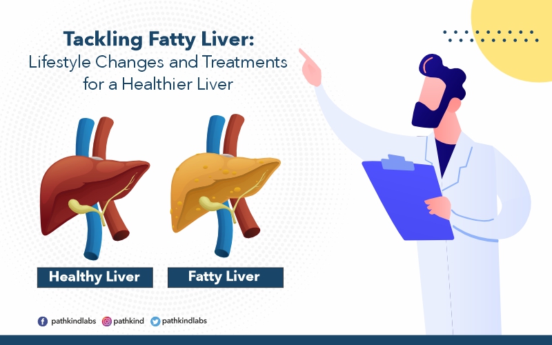 Understanding and Preventing Fatty Liver Disease
