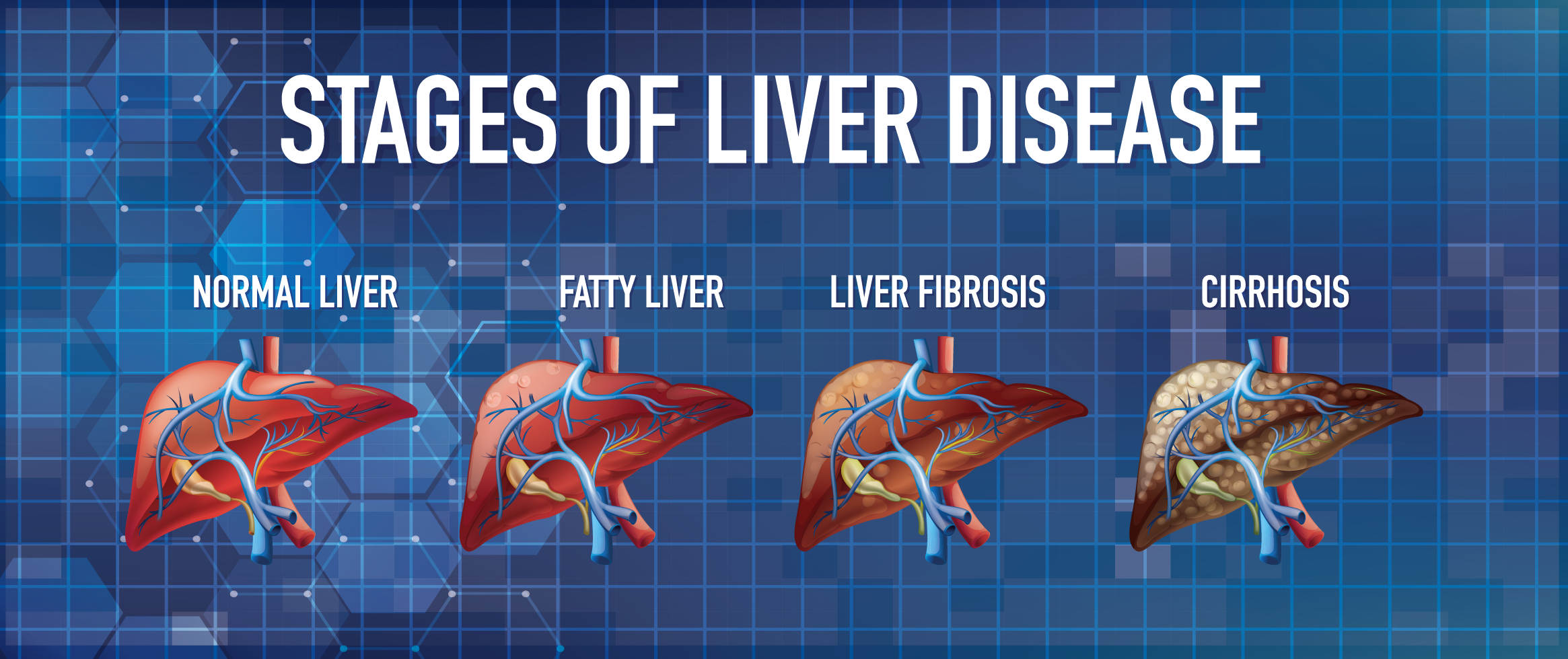 Understanding Liver Test Packages