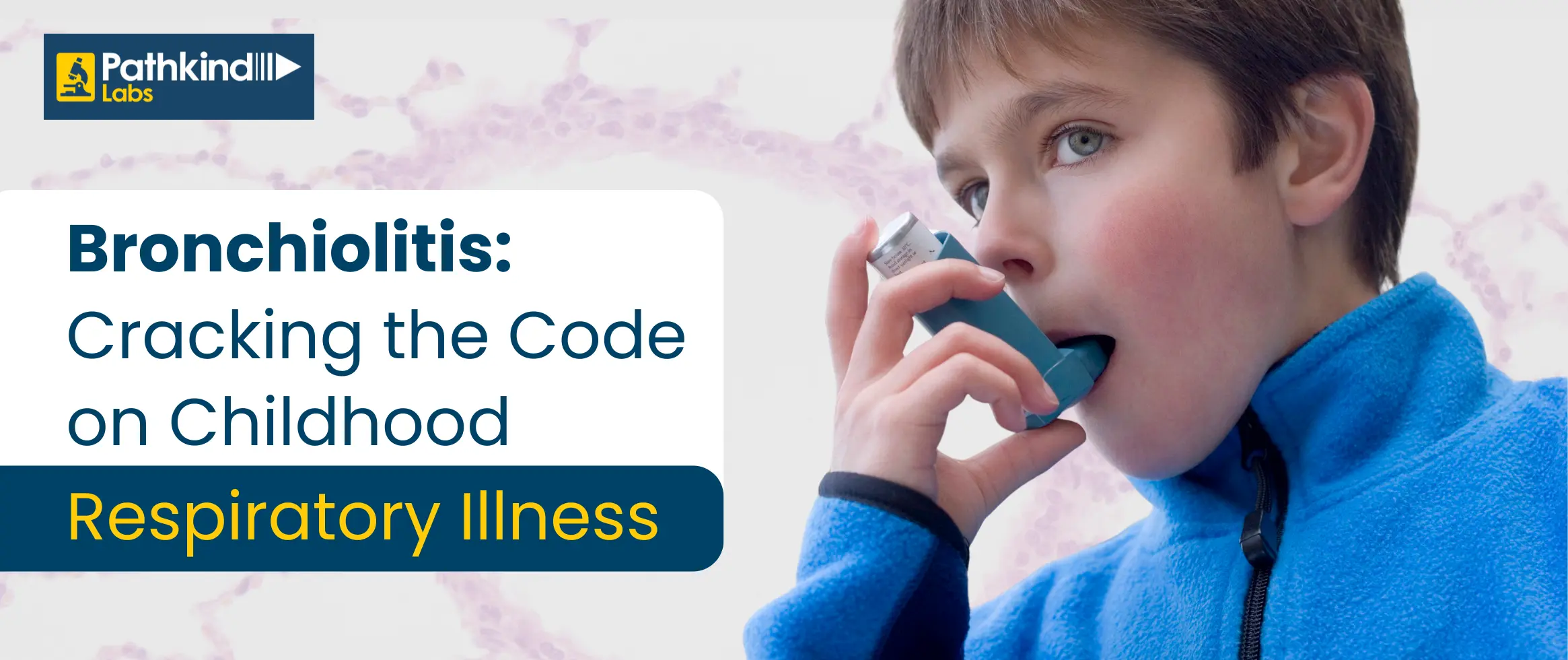  Bronchiolitis - Cracking the Code on Childhood Respiratory Illness