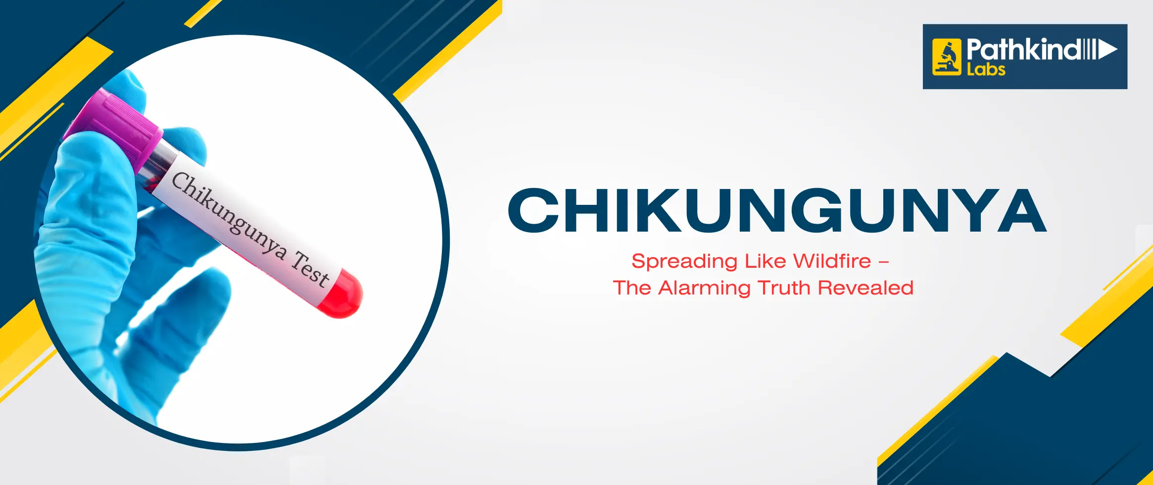  Chikungunya Spreading Like Wildfire – The Alarming Truth Revealed