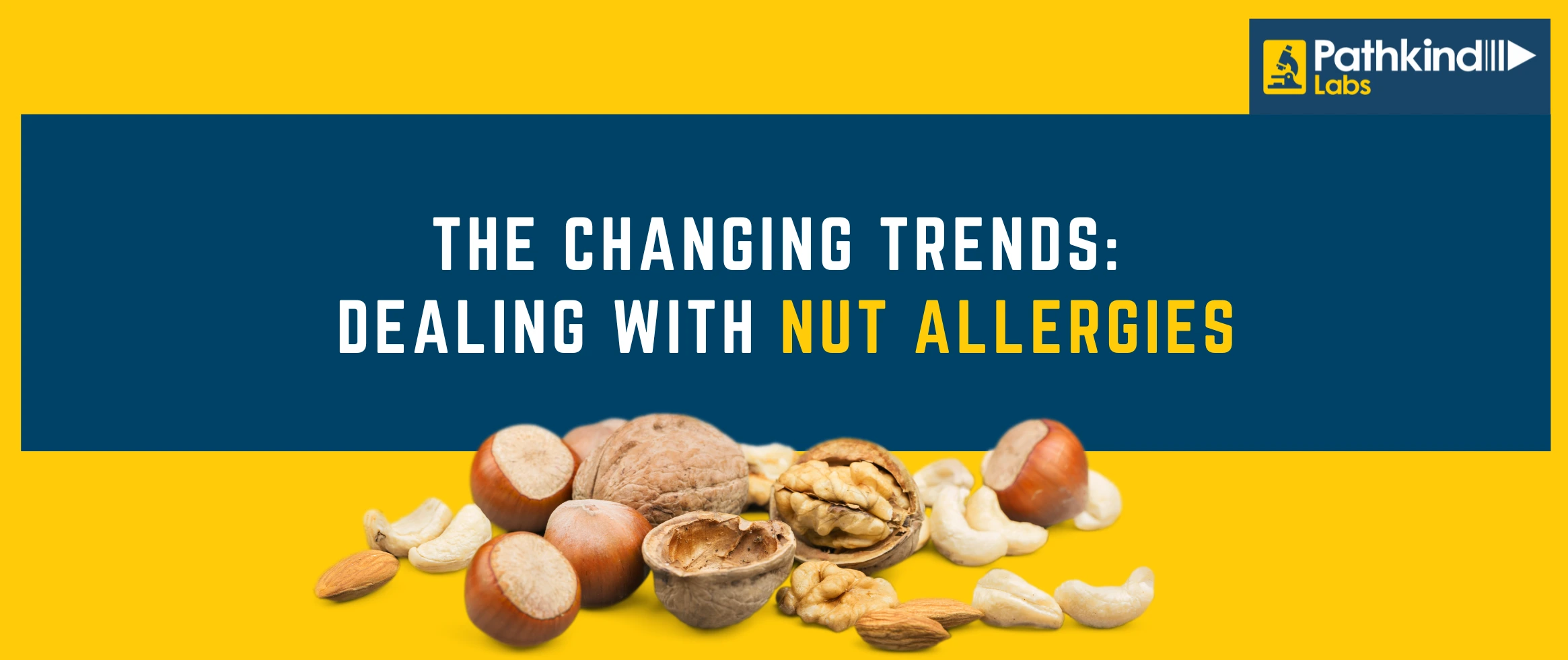 Dealing with Nut Allergies