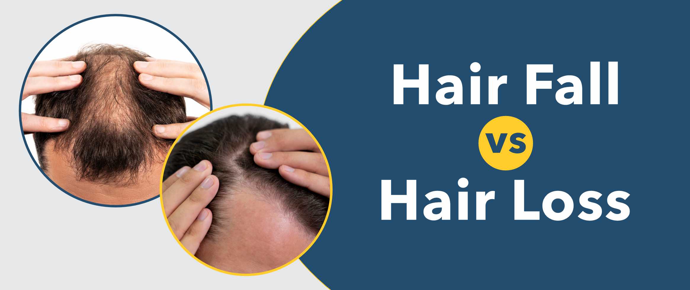 Hair Fall vs. Hair Loss: Understanding the Difference