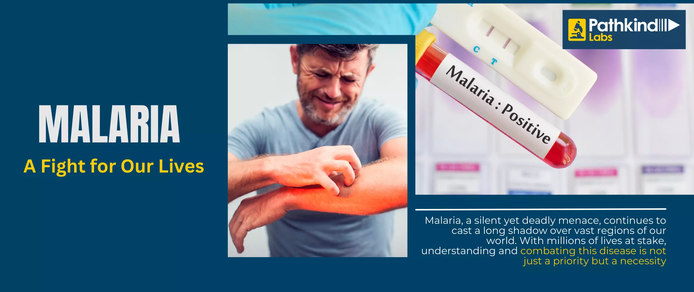 malaria testing and treatment